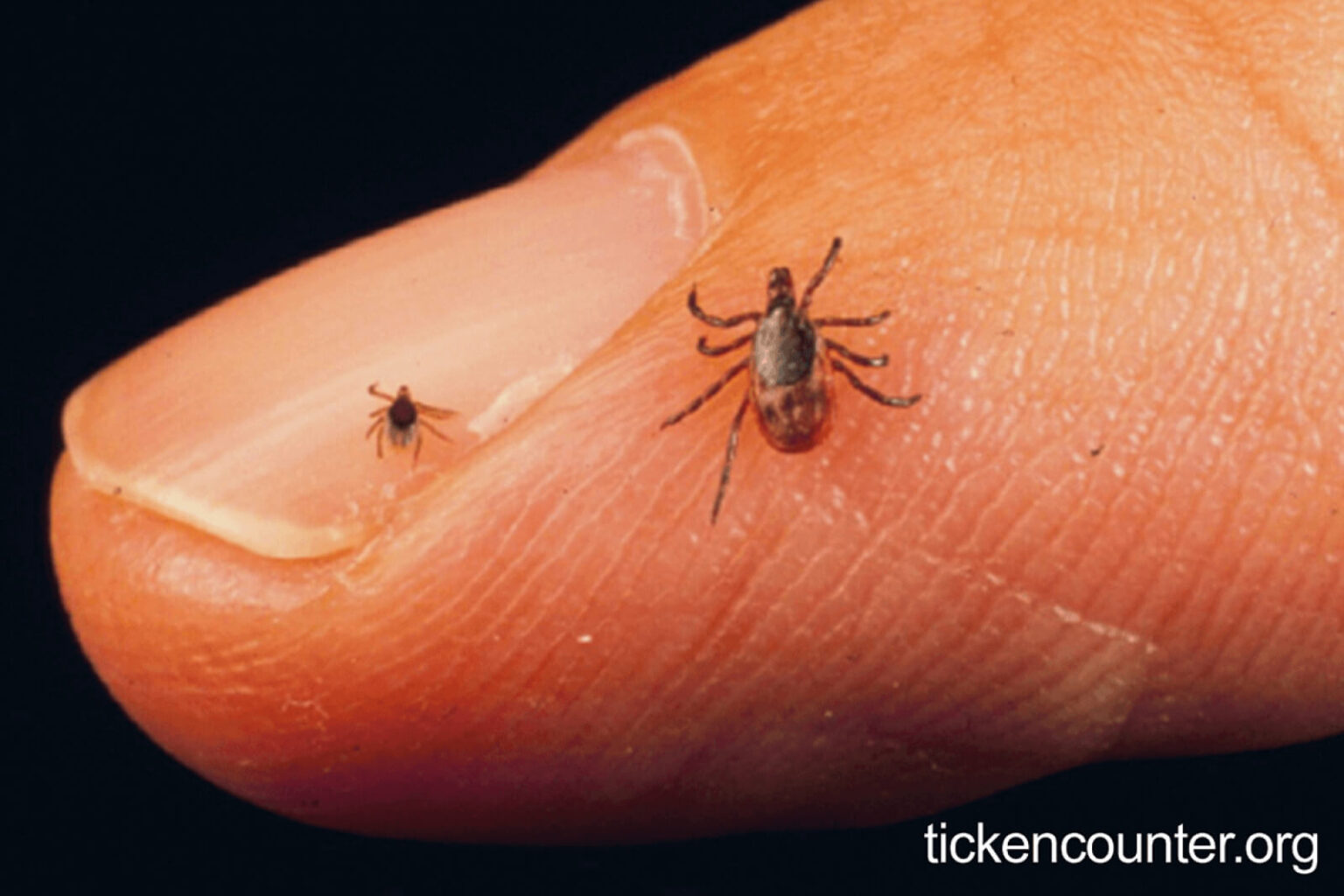 Watch out for ticks this season – Landscape Ontario